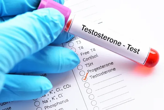 Testosterone